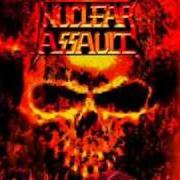 Le texte musical WHINE AND CHEESE de NUCLEAR ASSAULT est également présent dans l'album Third world genocide (2005)