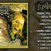 Le texte musical PUTRESCENCE de PATHOLOGIST est également présent dans l'album Grinding opus of forensic medical problems (1994)